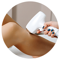 لیزر موهای زائد