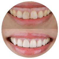 گامی اسمایل