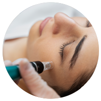 میکرونیدلینگ